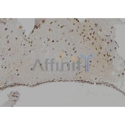 Валидация Affinity AF5167 - 2582