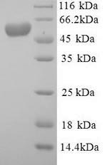 SDS-PAGE