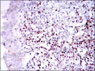 Валидация AntibodySystem RHF94702