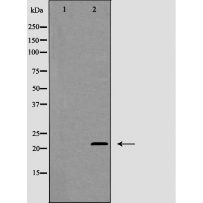 Валидация Affinity AF5295 - 2838