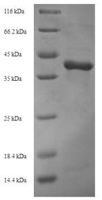 SDS-PAGE