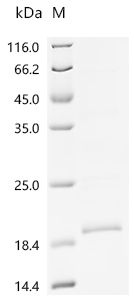 SDS-PAGE