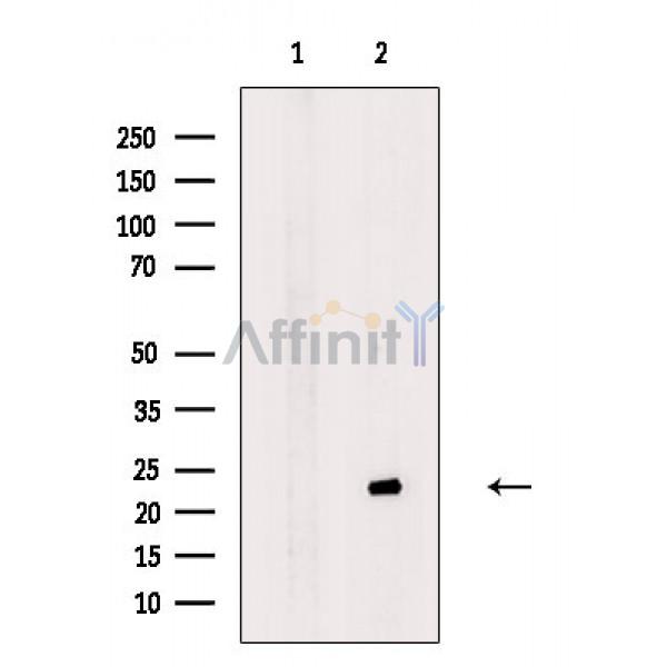 Валидация Affinity DF3664 - 14665