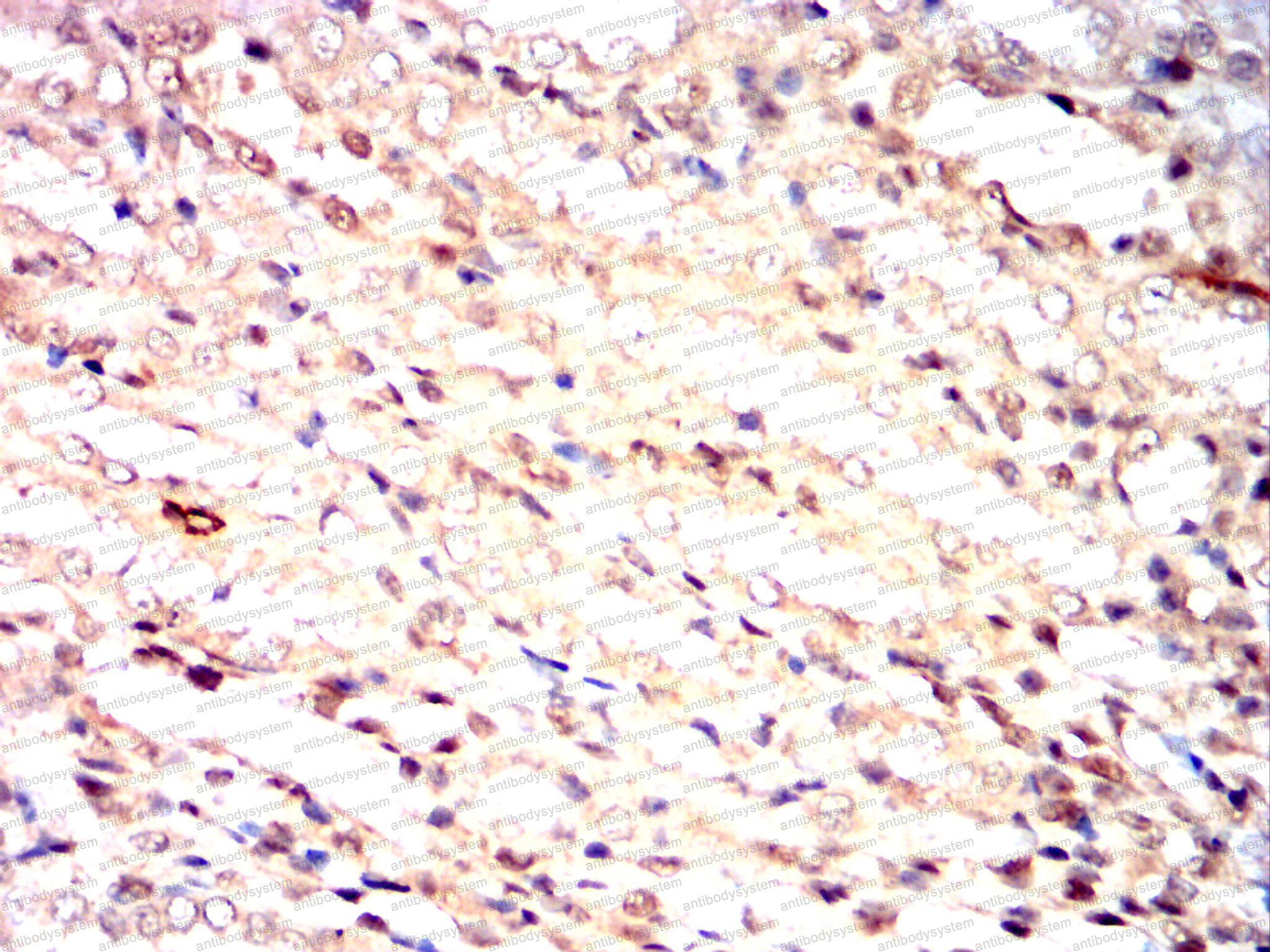 Валидация AntibodySystem RHE50004 (2211)
