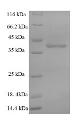 SDS-PAGE