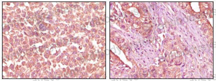 Валидация AntibodySystem RHD82401