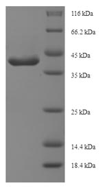 SDS-PAGE