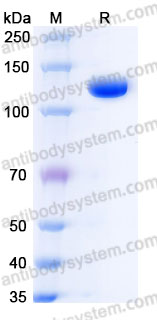 AWJ04001, SDS-PAGE