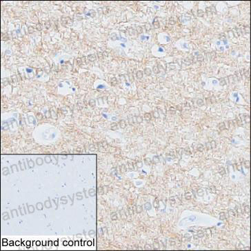 Валидация AntibodySystem RHD60303