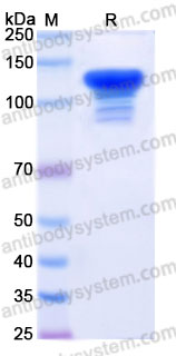 EHG99401, SDS-PAGE