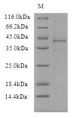 SDS-PAGE