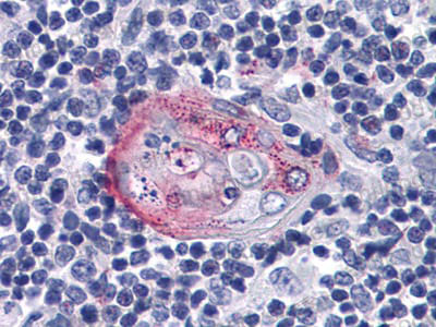 Валидация AntibodySystem RHD96601