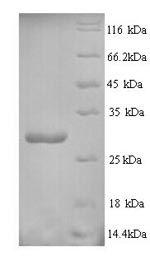 SDS-PAGE