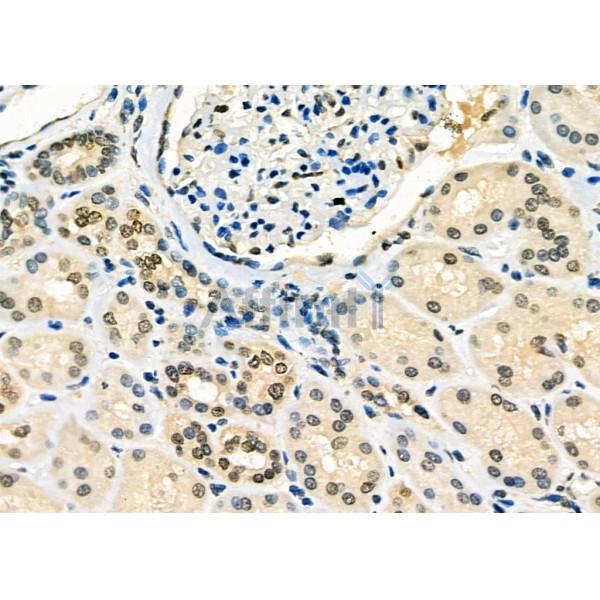 Валидация Affinity DF6498 - 17898