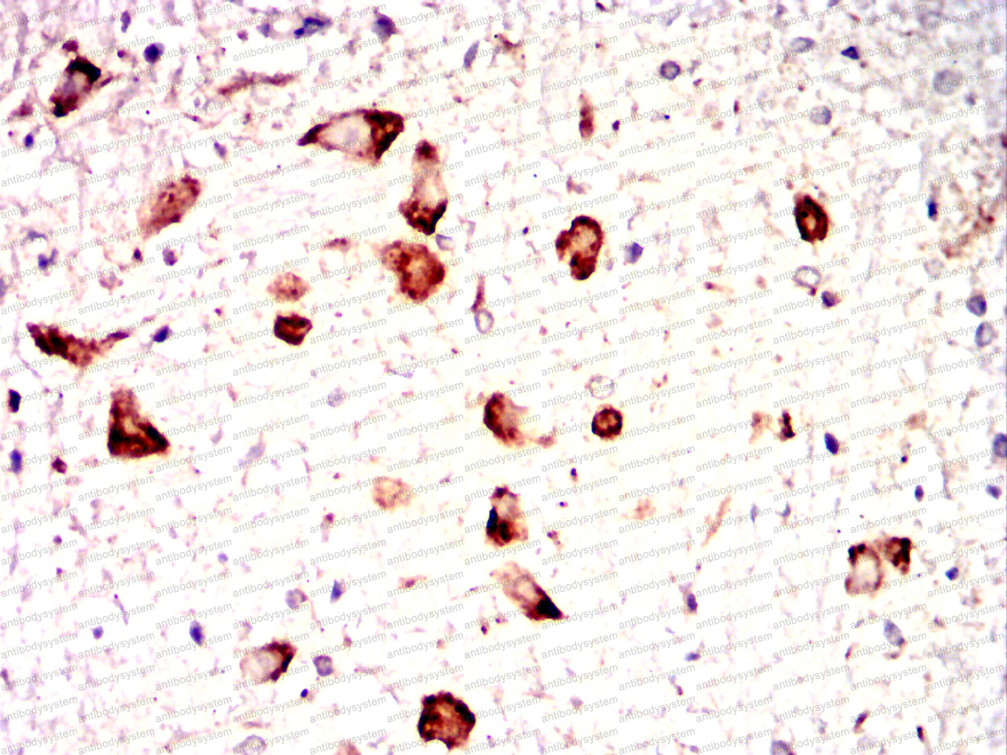 Валидация AntibodySystem RHC84902