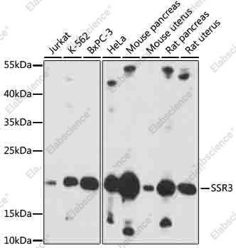 Вестерн-блоттинг, SSR3, различные клетки