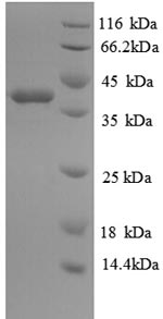 SDS-PAGE