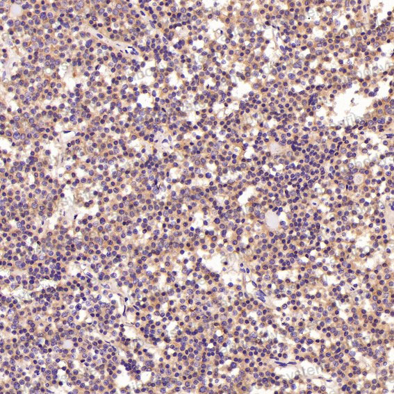 Валидация AntibodySystem RHN60301 (3837)