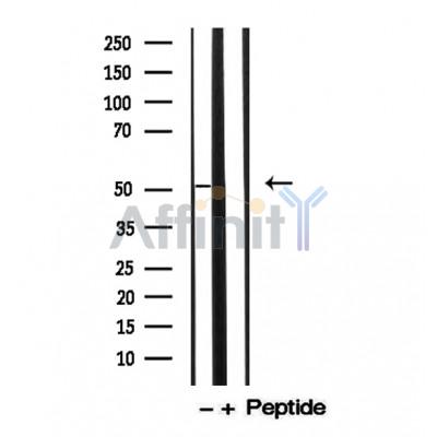 Валидация Affinity AF5102 - 2451