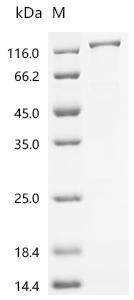 SDS-PAGE