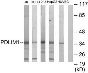 Валидация AssayVector ARM1839(2416)