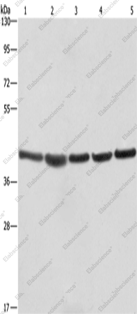 Вестерн-блоттинг, RPSA, клетки A549, NIH/3T3, 293T, HeLa и ткань гепатоцеллюлярной карциномы человека