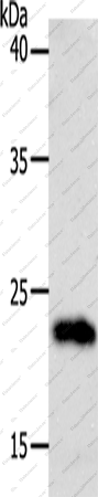 Вестерн-блоттинг, SOCS1, клетки 231