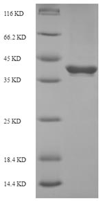 SDS-PAGE