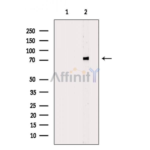 Валидация Affinity AF6702 - 3958