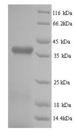 SDS-PAGE