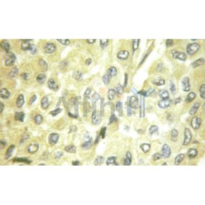 Валидация Affinity AF6242 - 3485