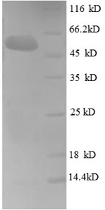 SDS-PAGE