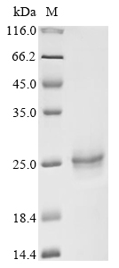 SDS-PAGE