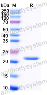 YZZ03101, SDS-PAGE