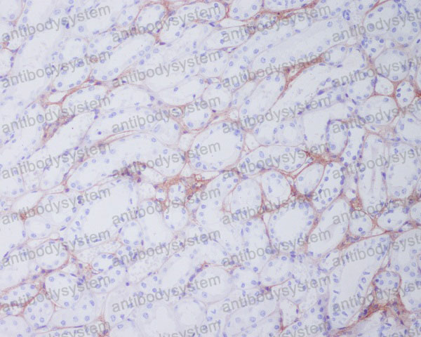 Валидация AntibodySystem RHB97402