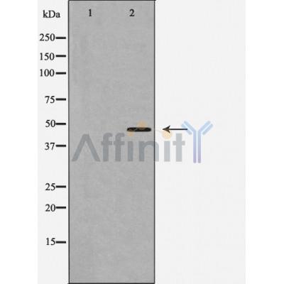 Валидация Affinity AF5418 - 3063