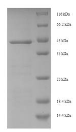 SDS-PAGE