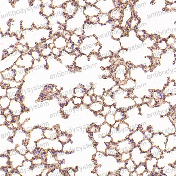 Валидация AntibodySystem RHC40302 (1004)