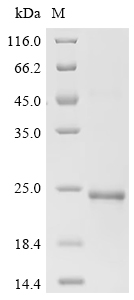 SDS-PAGE
