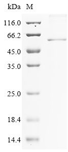 SDS-PAGE