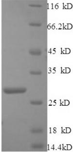 SDS-PAGE