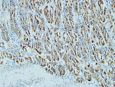 Валидация AntibodySystem RHD50005 (1615)