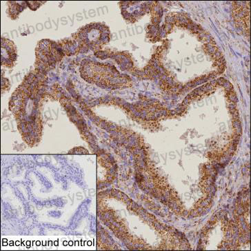Валидация AntibodySystem RHA31601