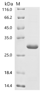 SDS-PAGE