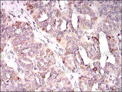 Валидация AntibodySystem RHE93203 (2402)