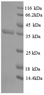 SDS-PAGE