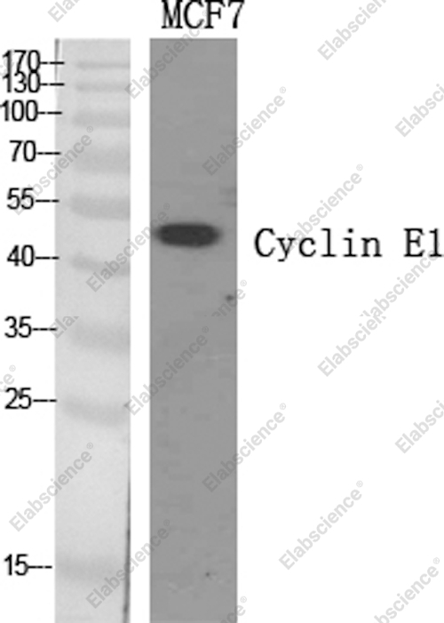Вестерн-блоттинг, Cyclin E1, клетки MCF7