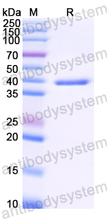 YZZ04501, SDS-PAGE