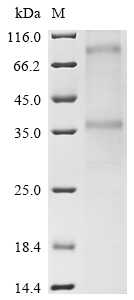 SDS-PAGE