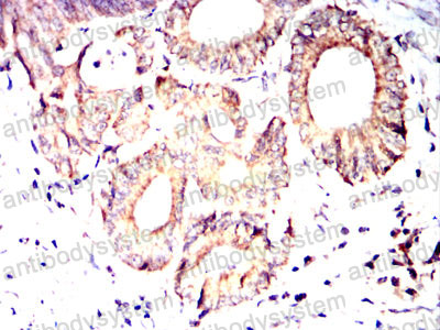 Валидация AntibodySystem RHC33504 (911)